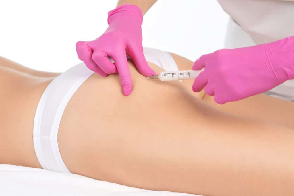 photo of woman getting qwo cellulite injection treatment