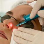 laser training